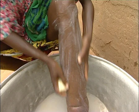 Lymphatic Fileriasis 16 (SEQUENCE) Stock Footage 39156939