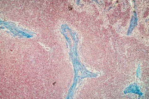 Lymphknoten Stock Photos