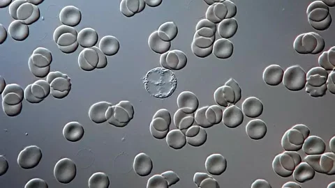 Lymphocytes in human blood under microscope, 1000x magnification Vídeos de archivo 306575237