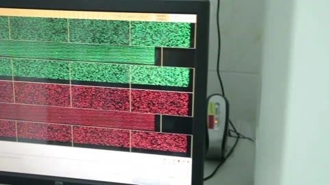 Machine  working in the laboratory with DNA and blood Stock Footage 136285121