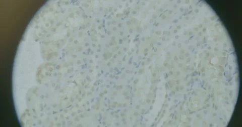 Macro Close-Up of Bacteria Under Microscope Stock Footage 318595123