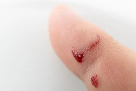 Macro close-up of a bleeding cut on a human finger isolated on white background Stock Photos