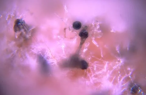 Macro close-up capturing the hairy mycelium and black sporangia of Rhizopus.. 스톡 사진