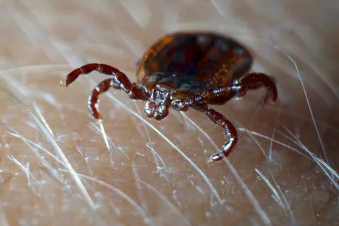 Macro close up of crawling tick on human skin. Stock Photos
