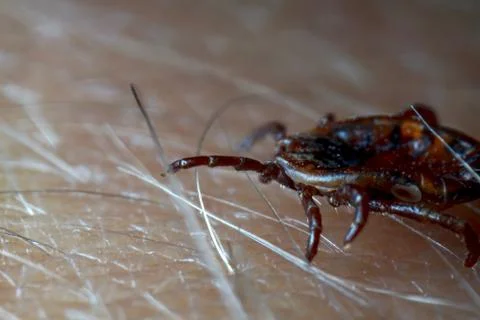 Macro close up of crawling tick on human skin. Stock Photos