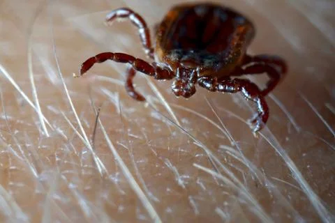 Macro close up of crawling tick on human skin. Stock Photos