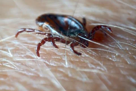 Macro close up of crawling tick on human skin. Stock Photos
