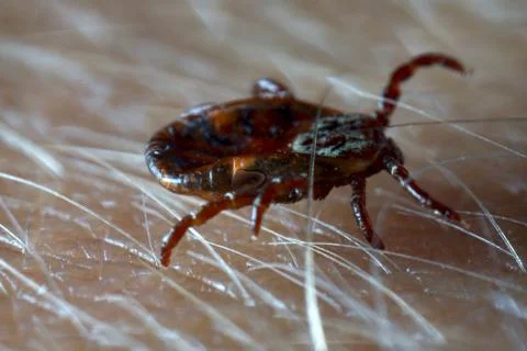 Macro close up of crawling tick on human skin. Stock Photos