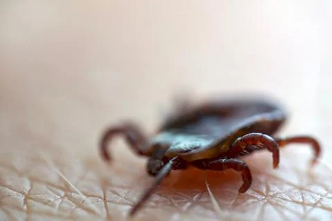 Macro close up of crawling tick on human skin. Stock Photos