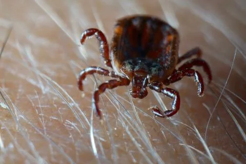 Macro close up of crawling tick on human skin. Foto stock