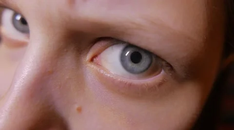 Macro Close-up eye blinking of an angry girl 4K UHD Stock Footage 62475932