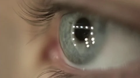 Macro Close-up eye blinking Stock-Footage 82997780