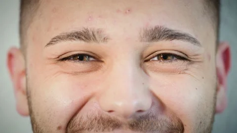 Macro close up of happy man's face smiling with beautiful hazel eye and pimples. Vídeos de archivo 167525017