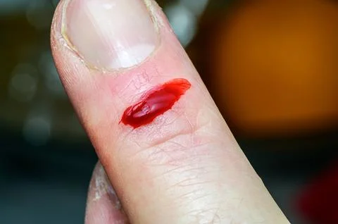 Macro close-up of a human finger with a deep cut and fresh red blood 스톡 사진
