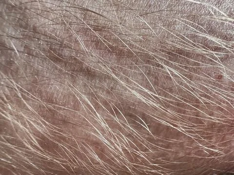 Macro close-up of senior human skin with white body hair, aged skin texture.. Photos