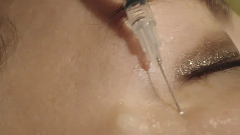 Macro Close-Up of Skin Injection Stock Footage 317497190
