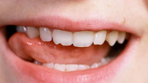 Macro closeup of a chipped tooth Stock Footage 154086573