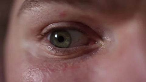 Macro closeup of an eye reacting to bright light Stock Footage 329586177