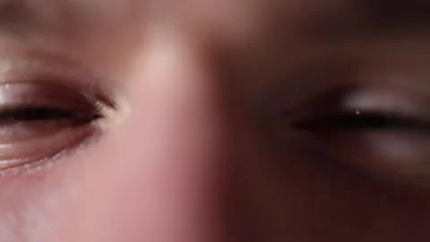 Macro closeup of unfocused tired eyes Stock Footage 329586181