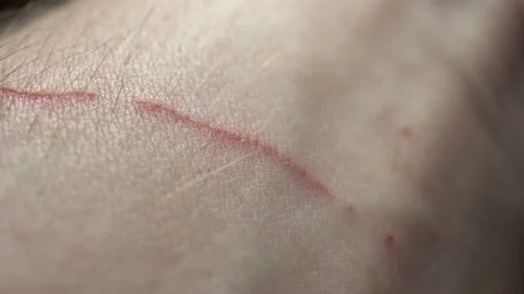 Macro Cut On Skin Background Stock Footage 134736831