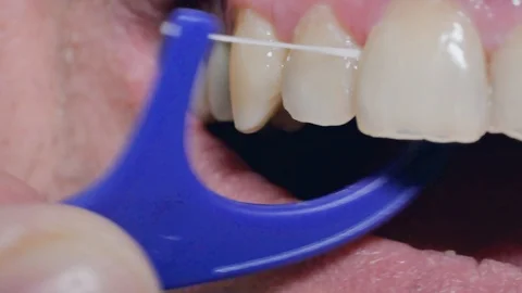 Macro of dental teeth cleaning process with floss Stockbeeldmateriaal 100894717