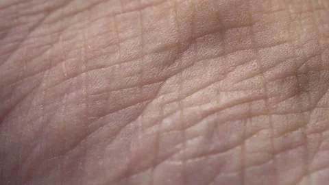 Macro Dents On Human Skin Background Stock Footage 201479952