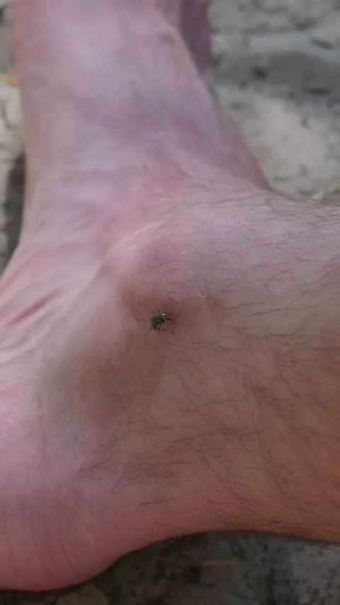 Macro Detail of a Fly Landing on Human Skin on a Sandy Beach 스톡 동영상 342769074