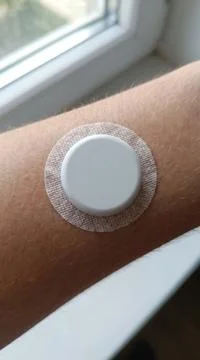 Macro Detail of White CGM Sensor Adhered to Skin Foto stock