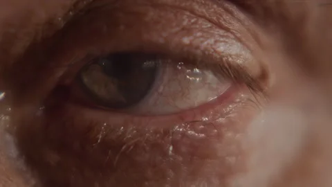 Macro, the eye of an elderly man after surgery looks in different directions Stock-Footage 344754738