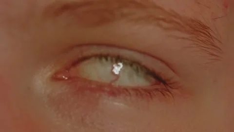 Macro of Eye rolling backwards into head and shivering like a seizure Stock Footage 258432287