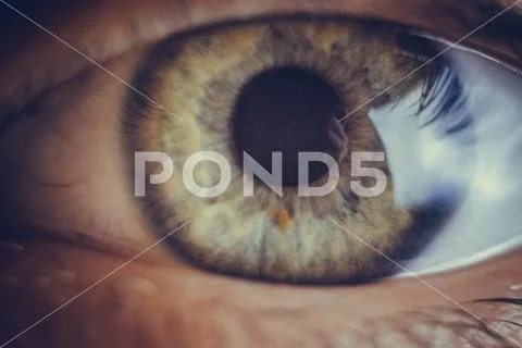 Macro eyes with bursting red blood vessels. eyeball covered with blood close Stock Photos
