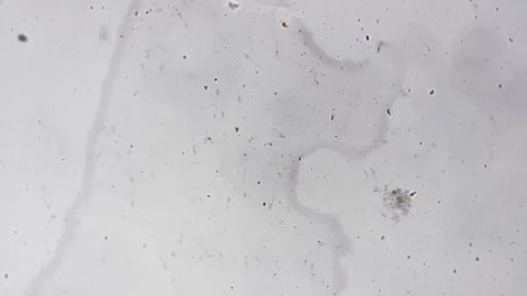 Macro footage of sperm smear sample magnified under microscope 200x and studied Stock Footage 247129802