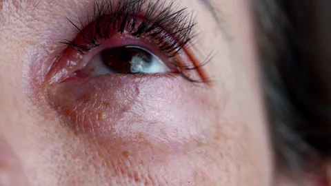 The macro image of the eye shows the natural texture of the skin  Stock Footage 301315073