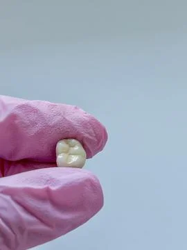 Macro image of a human molar held by fingers in a pink medical glove. Concept 스톡 사진