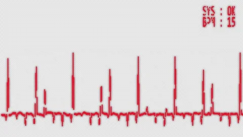 Macro led pixelmonitor displays a red digital hospital heart rhythm line graph. Stock Footage 337438958
