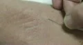 macro of needle in drawing blood HD Footage