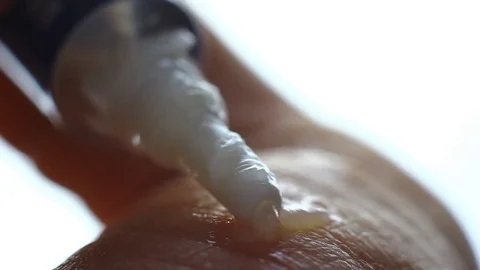 Macro of ointment tube, while applying medicine on a dried skin Stock Footage 84387192