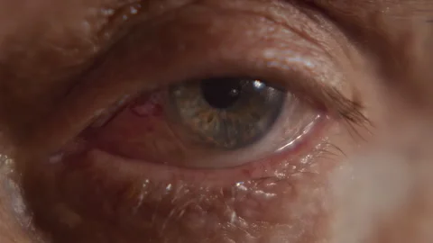 Macro, operated eye of an elderly man looking straight Stock-Footage 344754899