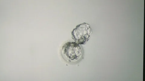 Macro shooting of embryo during lab manipulation Stock Footage 124988274