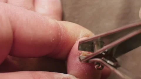 Macro shot: Clipping small toe nail with severe fungus. Video stock 267270867