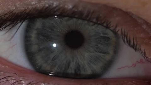 Macro shot of the contraction of the gray pupil of the human eye 스톡 동영상 171591553