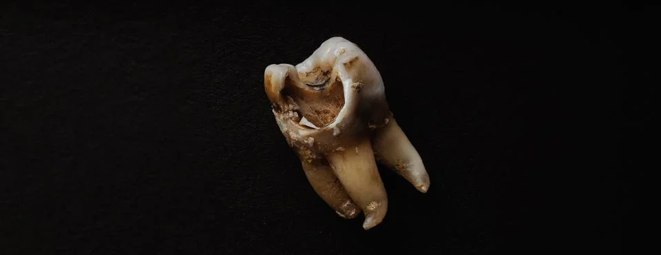 Macro shot of a decayed teeth till root after extraction of dentist. Stock Photos