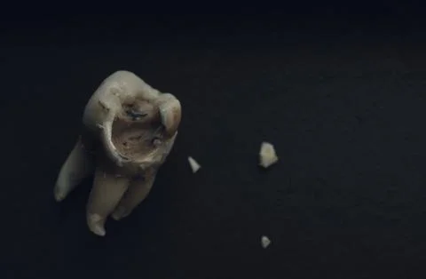 Macro shot of a decayed teeth till root after extraction of dentist. Stock Photos