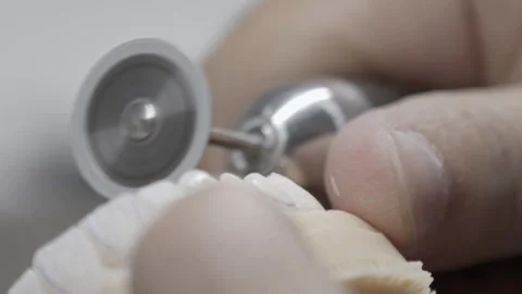 Macro Shot of Dental Prosthesis Manufacturing Stock Footage 332621152