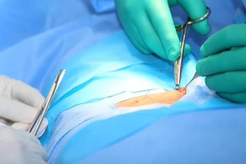 Macro shot of doctors making a suture in operation room.  focus in the tools. Stock Photos