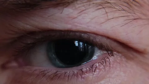 Macro shot of junkie man's eye with dilated pupil. 動画素材 274424796