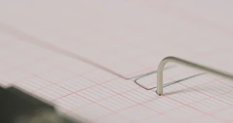Macro shot of lines from a lie detector machine Stock Footage 116559224