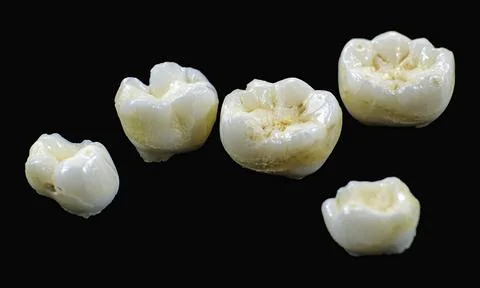 Macro shot of multiple dental teeth crowns arranged together on a black bac.. Stock Photos