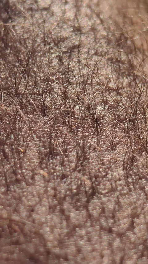 Macro Shot Panning Across Human Skin Revealing A Small Scar Stock Footage 315085806