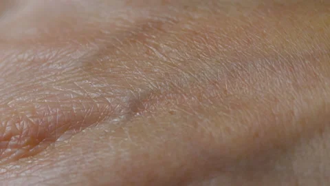 Macro Shot of Really Dry Old Human Skin. Close up Skin Texture With Wrinkles  Stock-Footage 142998403